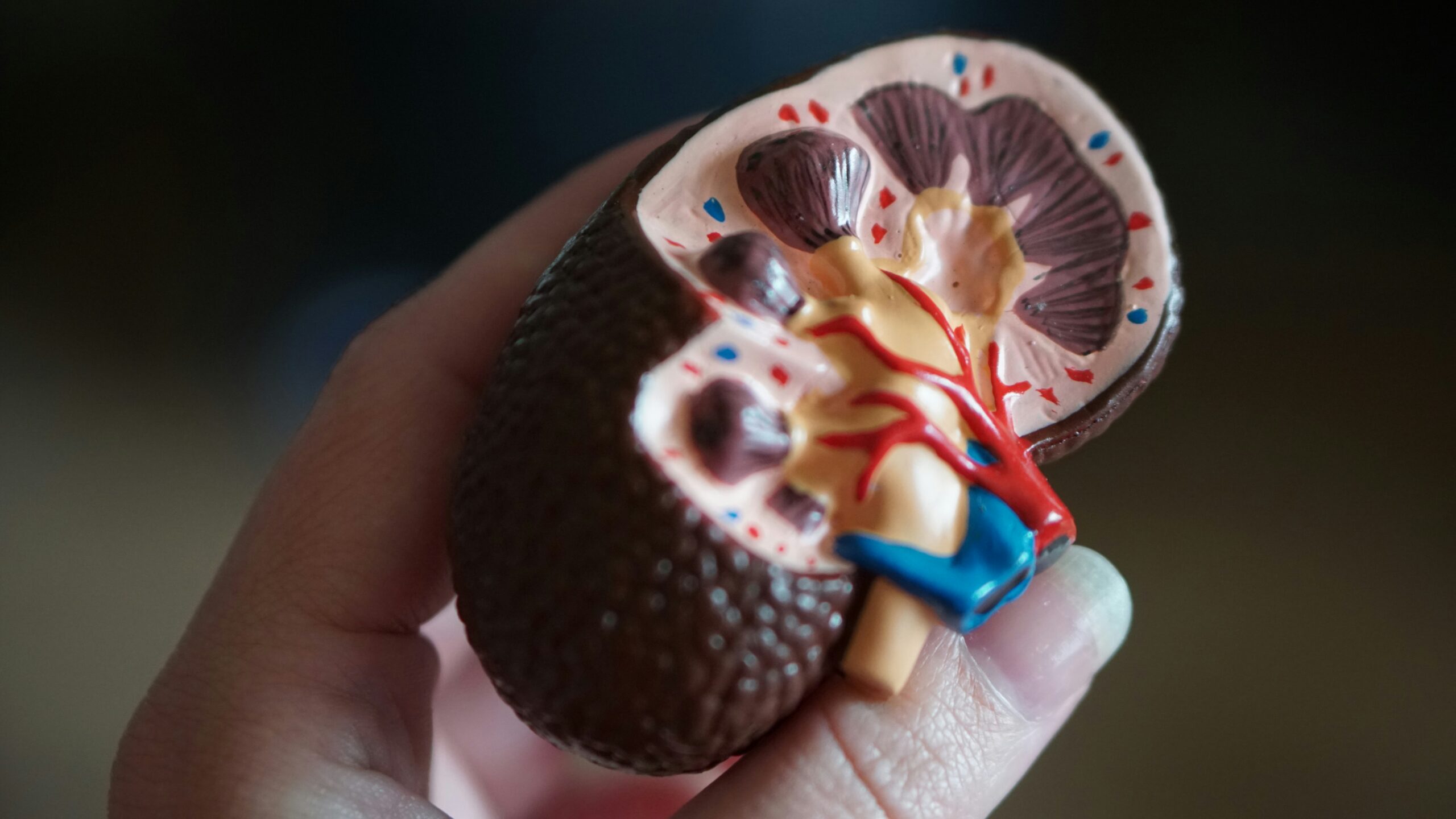 Saber o tipo de cálculo renal ajuda a prevenir novas crises